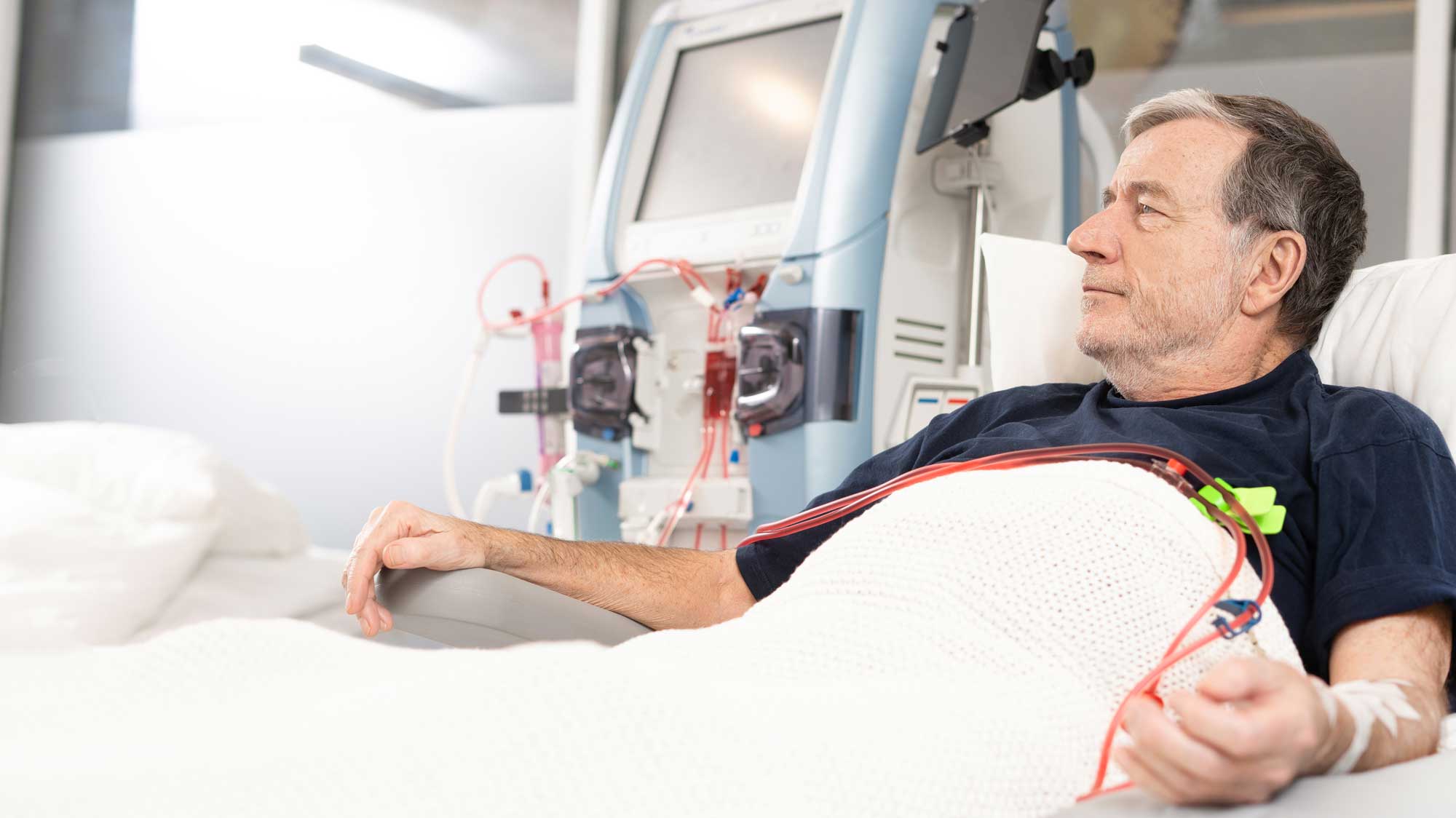 Care of vascular access for hemodialysis